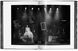 Peter Lindbergh. Untold Stories F000181 фото 3